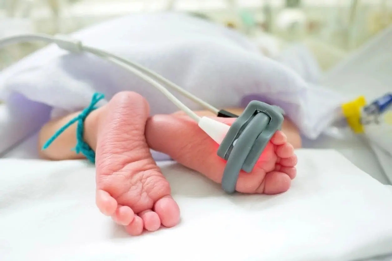 Newborn's feet with medical sensor attached.